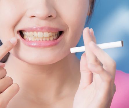 roken kan parodontitis veroorzaken